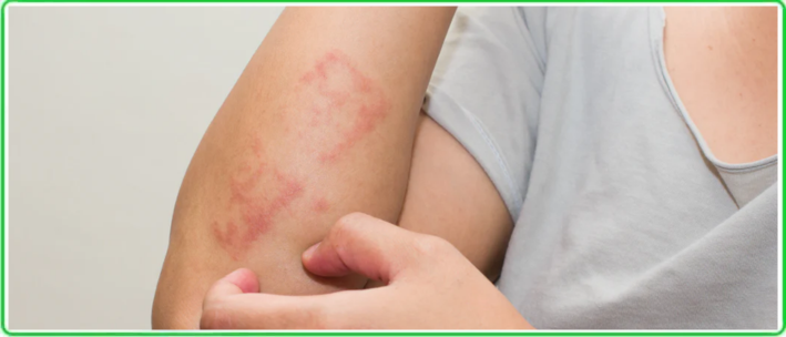first sign of skin disease