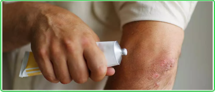 self treat skin