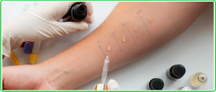 skin allergy treatment