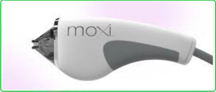 Moxi Laser