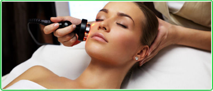 RF Face and Neck Lifting