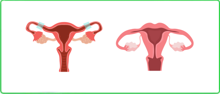 Treatment of Inflamatory diseases