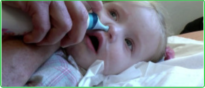 Nasal Irrigation in Children